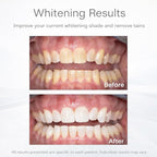 Opalescence Go™ 6% Prefilled Whitening Trays